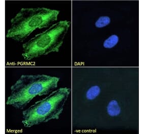 Immunofluorescence - Anti-PGRMC2 Antibody (A121176)