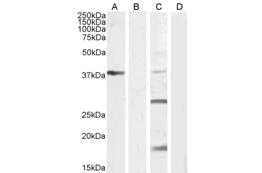 Western Blot - Anti-VEGFA Antibody (A121149) - Antibodies.com