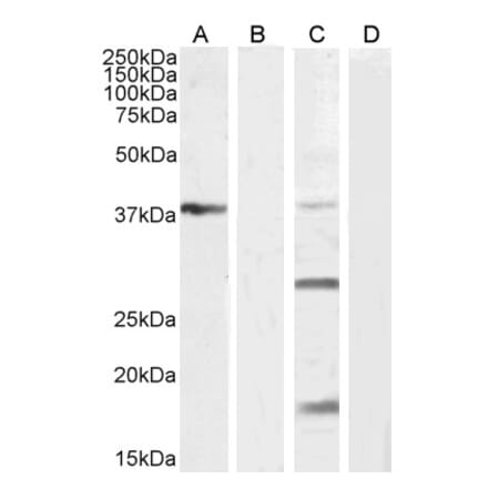 Western Blot - Anti-VEGFA Antibody (A121149) - Antibodies.com