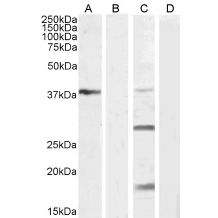 Western Blot - Anti-VEGFA Antibody (A121149) - Antibodies.com