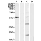 Western Blot - Anti-VEGFA Antibody (A121149) - Antibodies.com