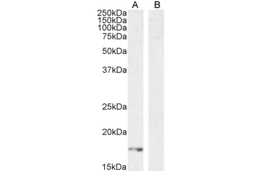 Western Blot - Anti-VEGFA Antibody (A121149) - Antibodies.com