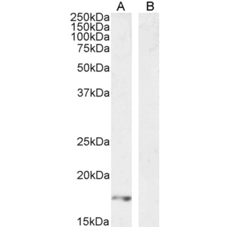 Western Blot - Anti-VEGFA Antibody (A121149) - Antibodies.com