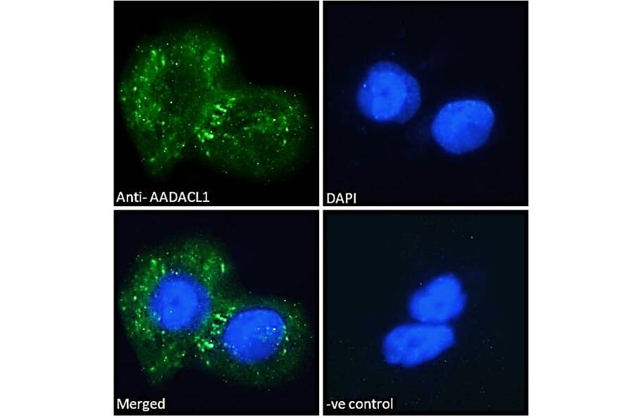Immunofluorescence - Anti-AADACL1 Antibody (A121150) - Antibodies.com