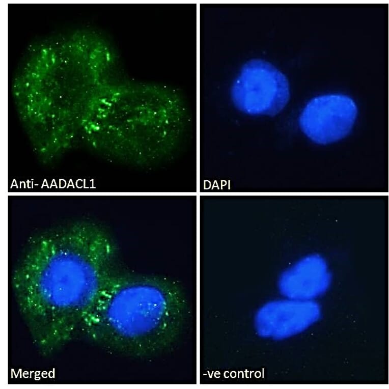 Immunofluorescence - Anti-AADACL1 Antibody (A121150) - Antibodies.com