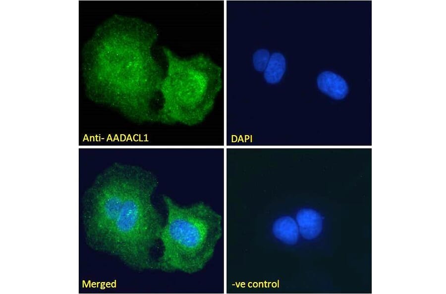 Immunofluorescence - Anti-AADACL1 Antibody (A121150) - Antibodies.com