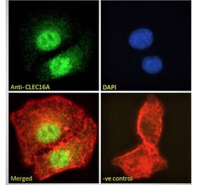 Immunofluorescence - Anti-CLEC16A Antibody (A121152) - Antibodies.com
