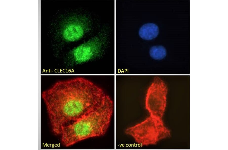 Immunofluorescence - Anti-CLEC16A Antibody (A121152) - Antibodies.com