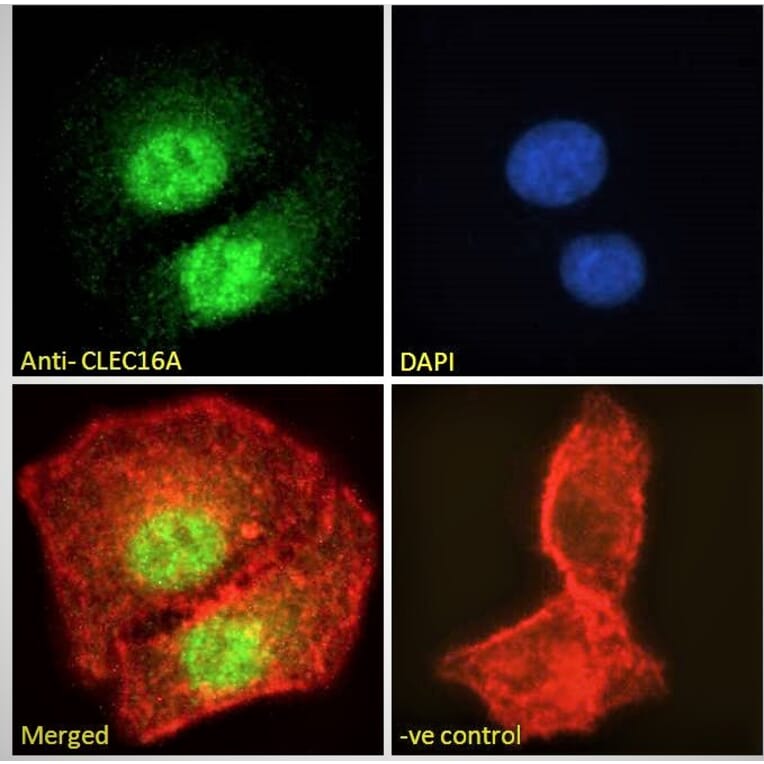 Immunofluorescence - Anti-CLEC16A Antibody (A121152) - Antibodies.com