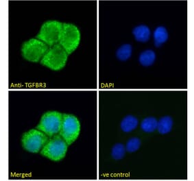 Immunofluorescence - Anti-TGFBR3 Antibody (A121154) - Antibodies.com