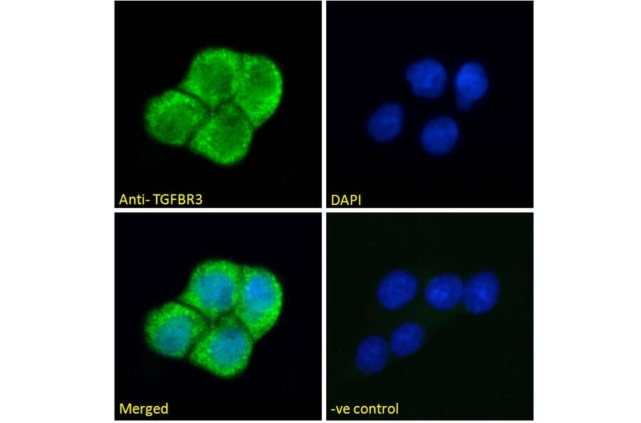 Immunofluorescence - Anti-TGFBR3 Antibody (A121154) - Antibodies.com