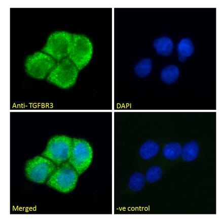 Immunofluorescence - Anti-TGFBR3 Antibody (A121154) - Antibodies.com