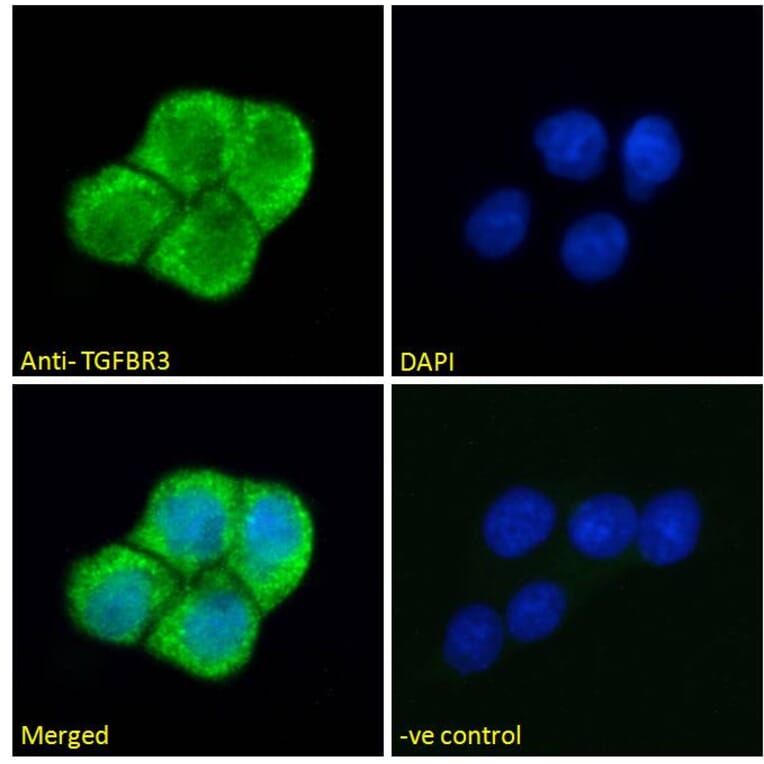 Immunofluorescence - Anti-TGFBR3 Antibody (A121154) - Antibodies.com