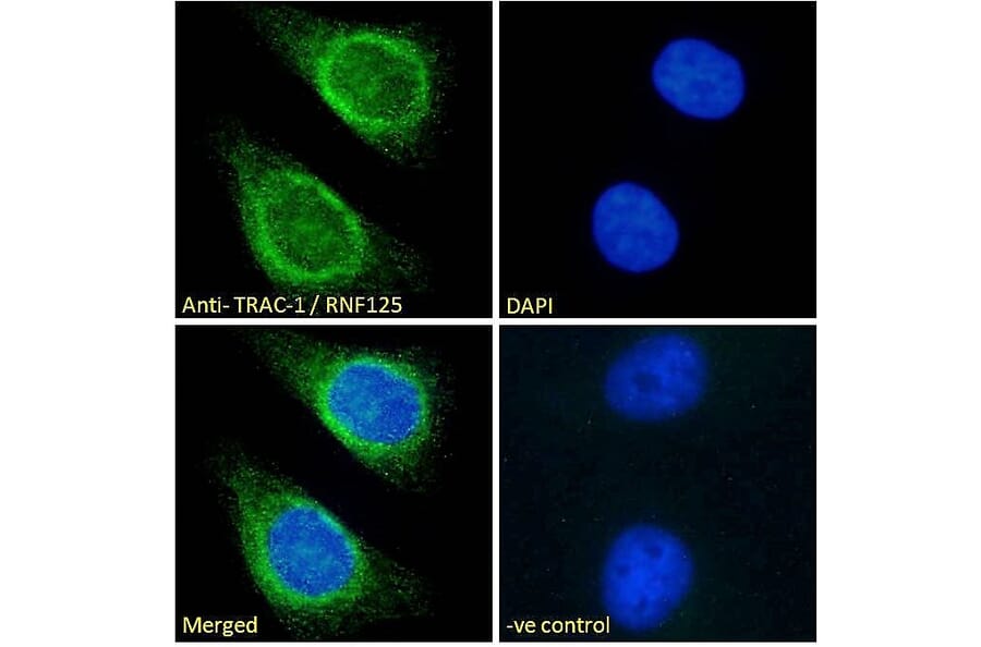 Immunofluorescence - Anti-RNF125 Antibody (A121155) - Antibodies.com