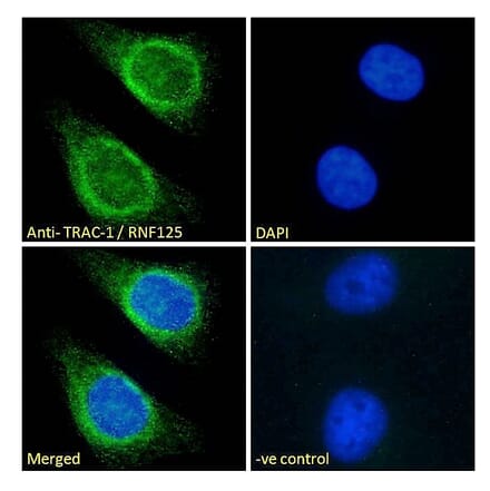 Immunofluorescence - Anti-RNF125 Antibody (A121155) - Antibodies.com