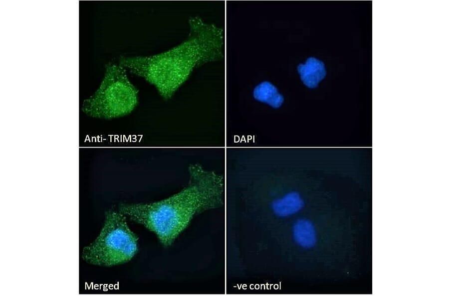 Immunofluorescence - Anti-TRIM37 Antibody (A121156) - Antibodies.com