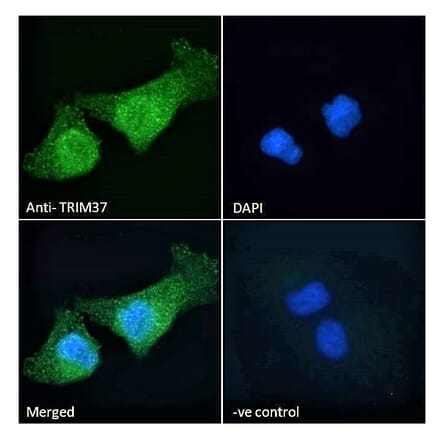 Immunofluorescence - Anti-TRIM37 Antibody (A121156) - Antibodies.com