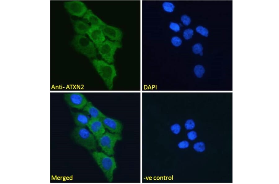 Immunofluorescence - Anti-SCA2 Antibody (A121157) - Antibodies.com