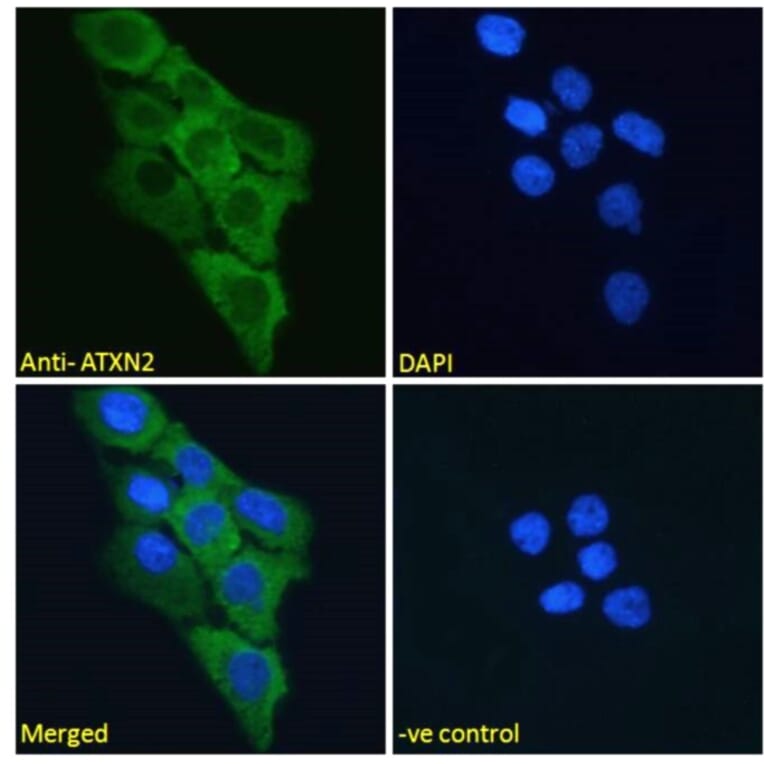 Immunofluorescence - Anti-SCA2 Antibody (A121157) - Antibodies.com