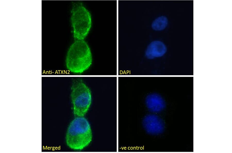 Immunofluorescence - Anti-SCA2 Antibody (A121157) - Antibodies.com