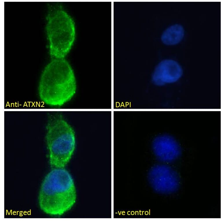Immunofluorescence - Anti-SCA2 Antibody (A121157) - Antibodies.com