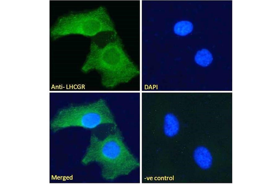 Immunofluorescence - Anti-hCG Receptor/LHR Antibody (A121158) - Antibodies.com