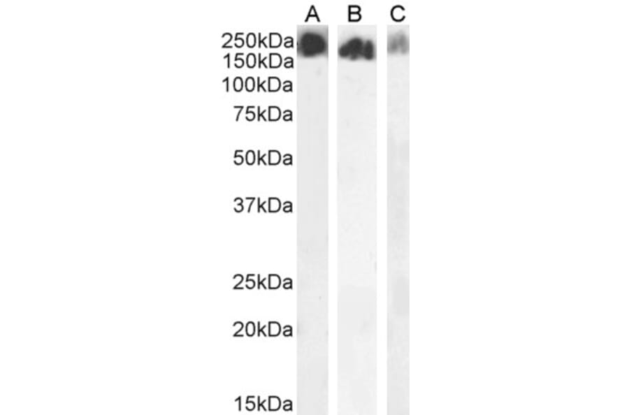 Western Blot - Anti-SCRIBBLE Antibody (A121159) - Antibodies.com