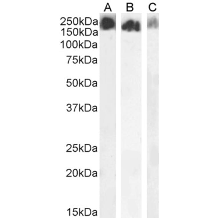 Western Blot - Anti-SCRIBBLE Antibody (A121159) - Antibodies.com