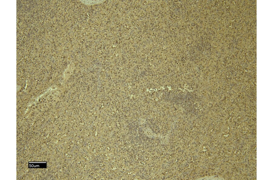 Immunohistochemistry - Anti-CXCR3 Antibody (A121162) - Antibodies.com