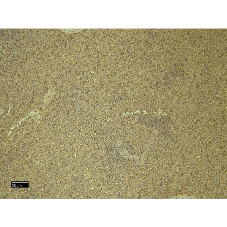 Immunohistochemistry - Anti-CXCR3 Antibody (A121162) - Antibodies.com