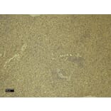 Immunohistochemistry - Anti-CXCR3 Antibody (A121162) - Antibodies.com
