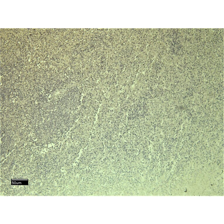 Immunohistochemistry - Anti-CXCR3 Antibody (A121162) - Antibodies.com