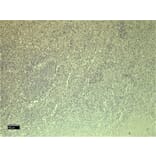 Immunohistochemistry - Anti-CXCR3 Antibody (A121162) - Antibodies.com