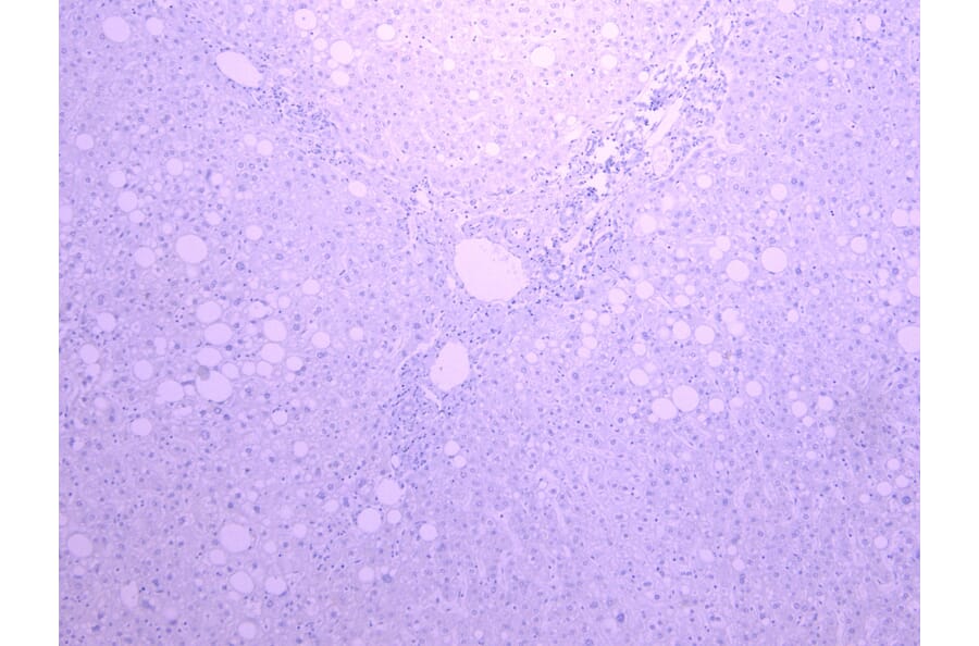 Immunohistochemistry - Anti-Cytochrome P450 3A4/CYP3A4 Antibody (A121165) - Antibodies.com