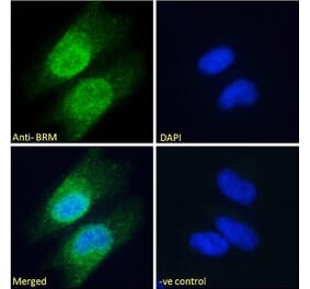 Immunofluorescence - Anti-BRM Antibody (A121174)