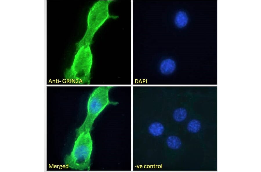 Immunofluorescence - Anti-NMDAR2A Antibody (A121167) - Antibodies.com