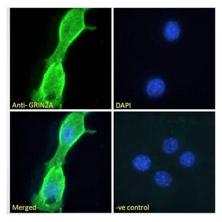 Immunofluorescence - Anti-NMDAR2A Antibody (A121167) - Antibodies.com