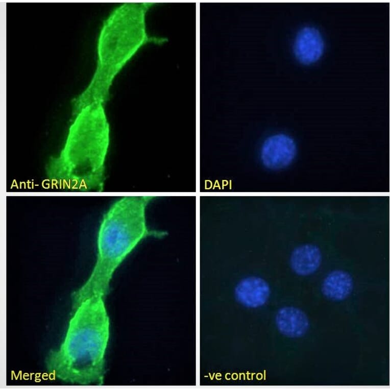 Immunofluorescence - Anti-NMDAR2A Antibody (A121167) - Antibodies.com