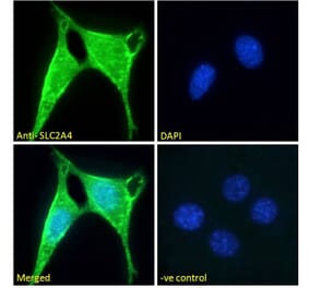 Immunofluorescence - Anti-Glucose Transporter GLUT4 Antibody (A121168) - Antibodies.com