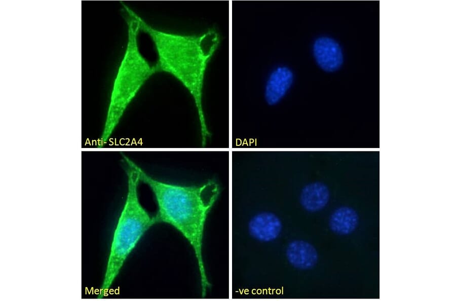 Immunofluorescence - Anti-Glucose Transporter GLUT4 Antibody (A121168) - Antibodies.com