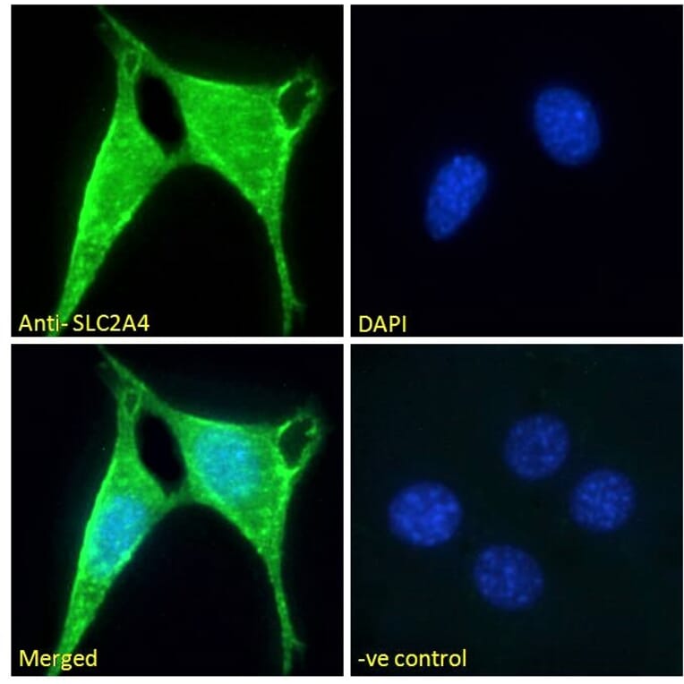 Immunofluorescence - Anti-Glucose Transporter GLUT4 Antibody (A121168) - Antibodies.com