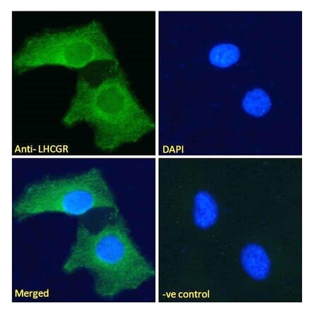 Immunofluorescence - Anti-LHCGR Antibody (A121158)