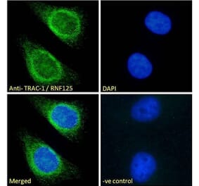 Immunofluorescence - Anti-TRAC-1 Antibody (A121155)