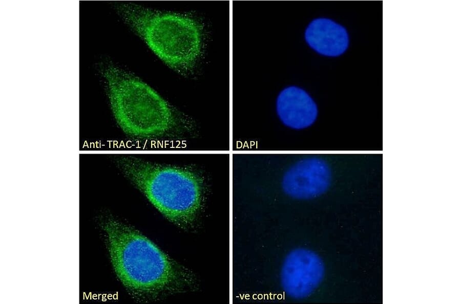 Immunofluorescence - Anti-TRAC-1 Antibody (A121155)