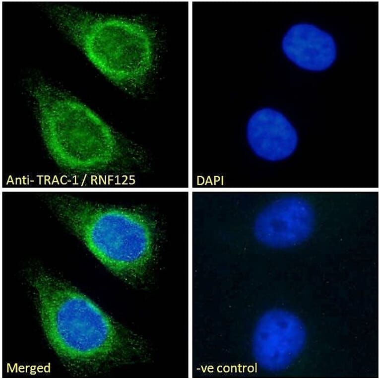 Immunofluorescence - Anti-TRAC-1 Antibody (A121155)