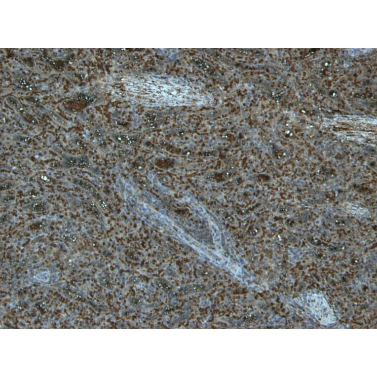 Immunohistochemistry - Anti-TLR4 Antibody (A121173) - Antibodies.com
