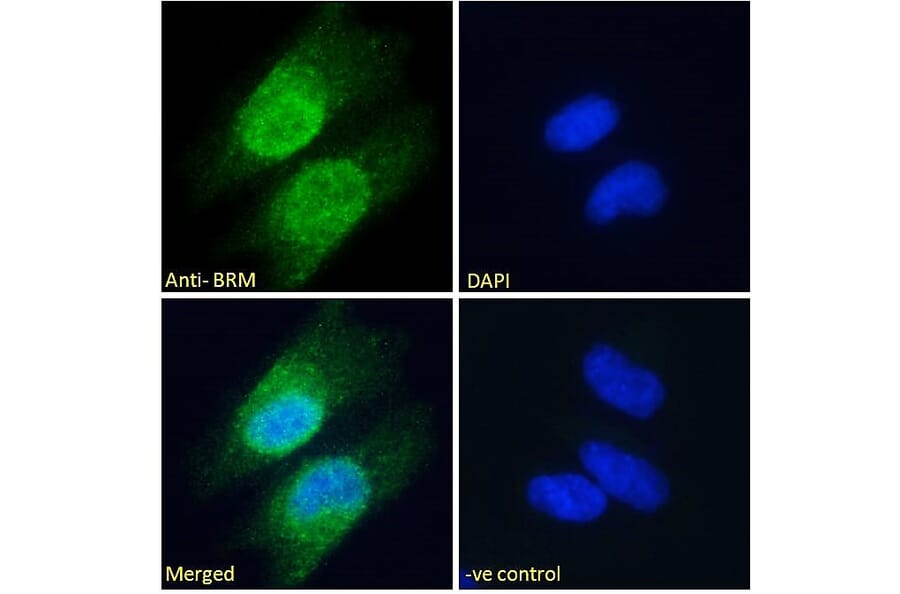 Immunofluorescence - Anti-BRM Antibody (A121174) - Antibodies.com