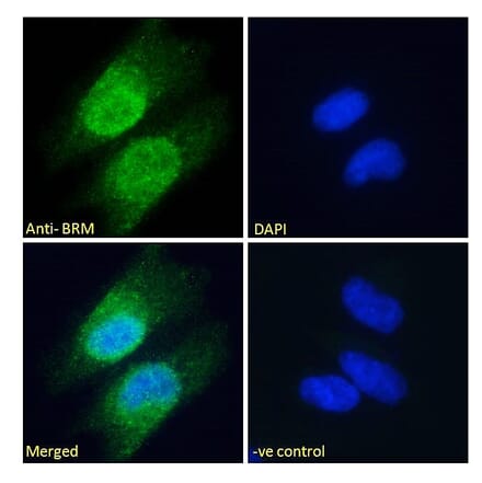 Immunofluorescence - Anti-BRM Antibody (A121174) - Antibodies.com