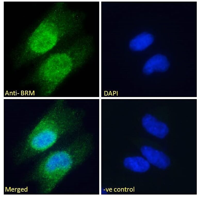 Immunofluorescence - Anti-BRM Antibody (A121174) - Antibodies.com