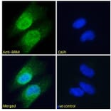 Immunofluorescence - Anti-BRM Antibody (A121174) - Antibodies.com